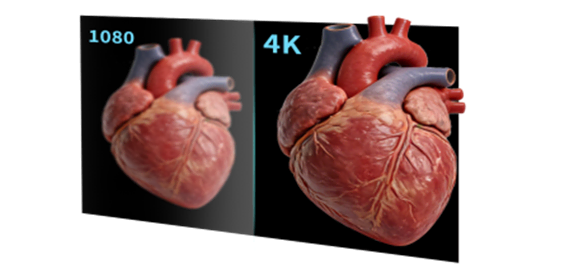 Comparison of Full HD and 4K resolution medical imaging on a heart model