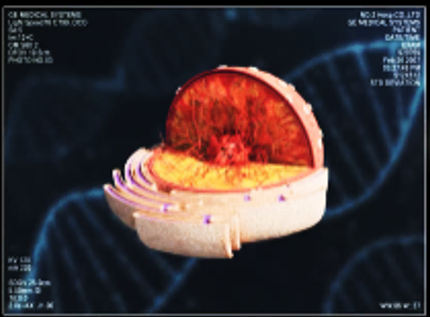 Medical imaging example shown with enhanced color gamut and image detail